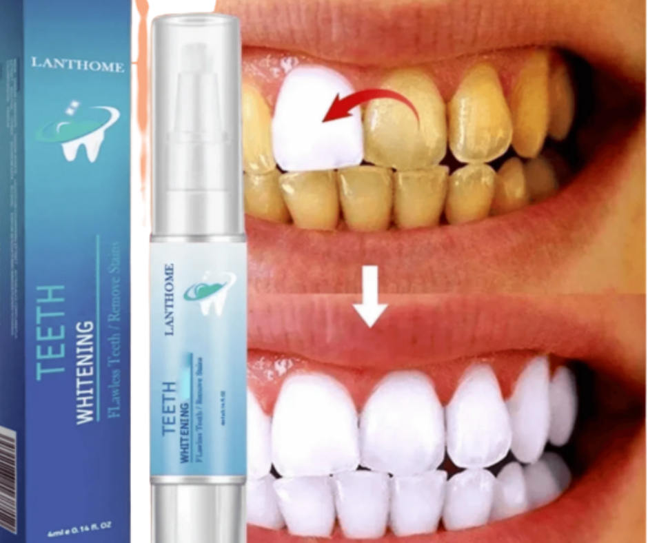 Theet Plus ✅ Pluma Blanqueadora de Dientes + Envío Gratis.